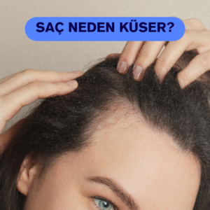 Saç küsmesi nedir? Saç neden küser?