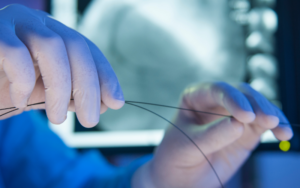 stent mi bypass mı? stent bypass karşılaştırması